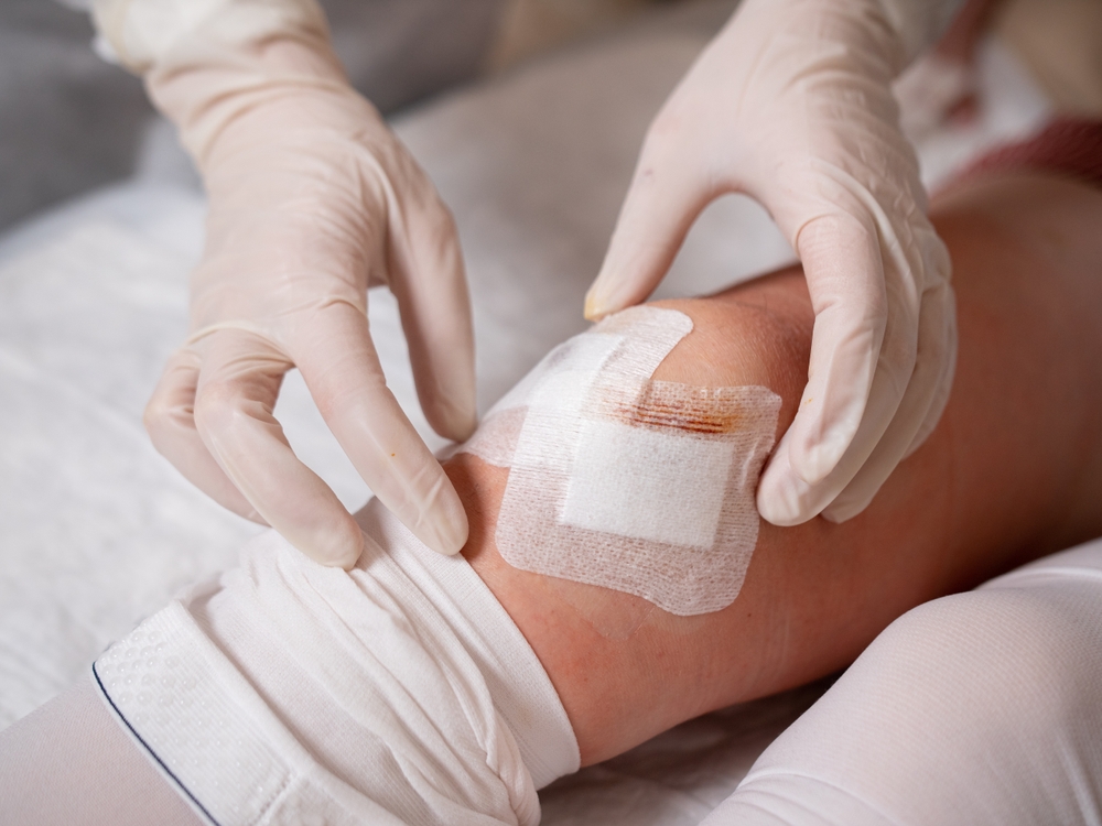 wound dressing